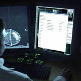 Picture of Mammography Continuing Experience: Multi-Reading up to 1000 Exams