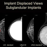 Picture of The Altered Breast