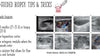 Ultrasound-guided Breast Biopsies - Efficiency Learning Systems