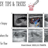 Picture of Ultrasound-guided Breast Biopsies