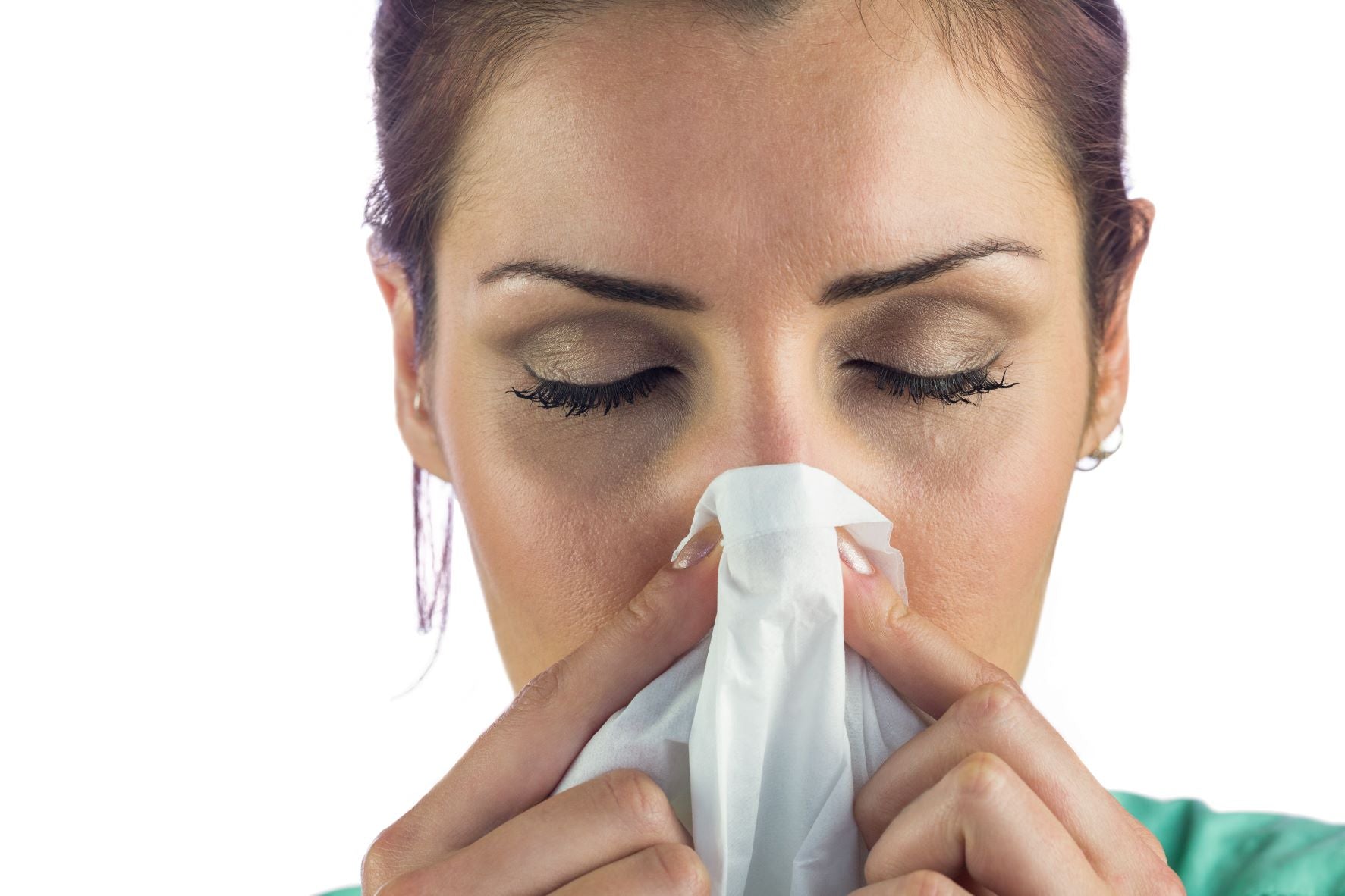 Woman with allergies and dark circles under her eyes blowing her nose