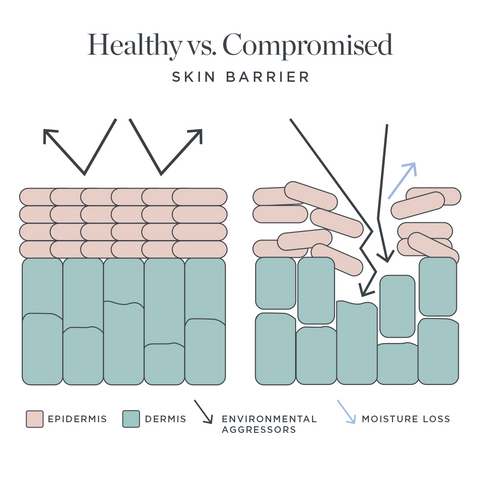 Healthy vs. Compromised Skin Barrier