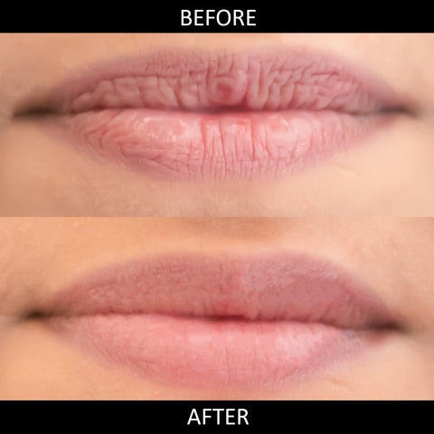 omorfee-hydrating-lip-salve-good-lip-balm-for-dry-chapped-lips