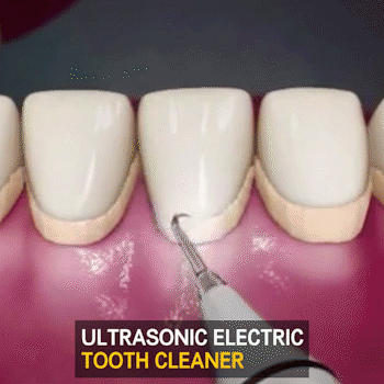 iToothPro™ Ultrasonic Tooth Cleaner in kenya