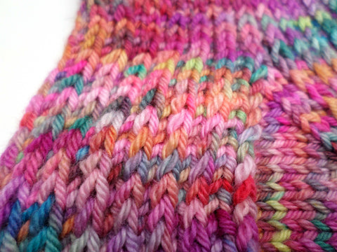 Sock Fever – Skein Queen