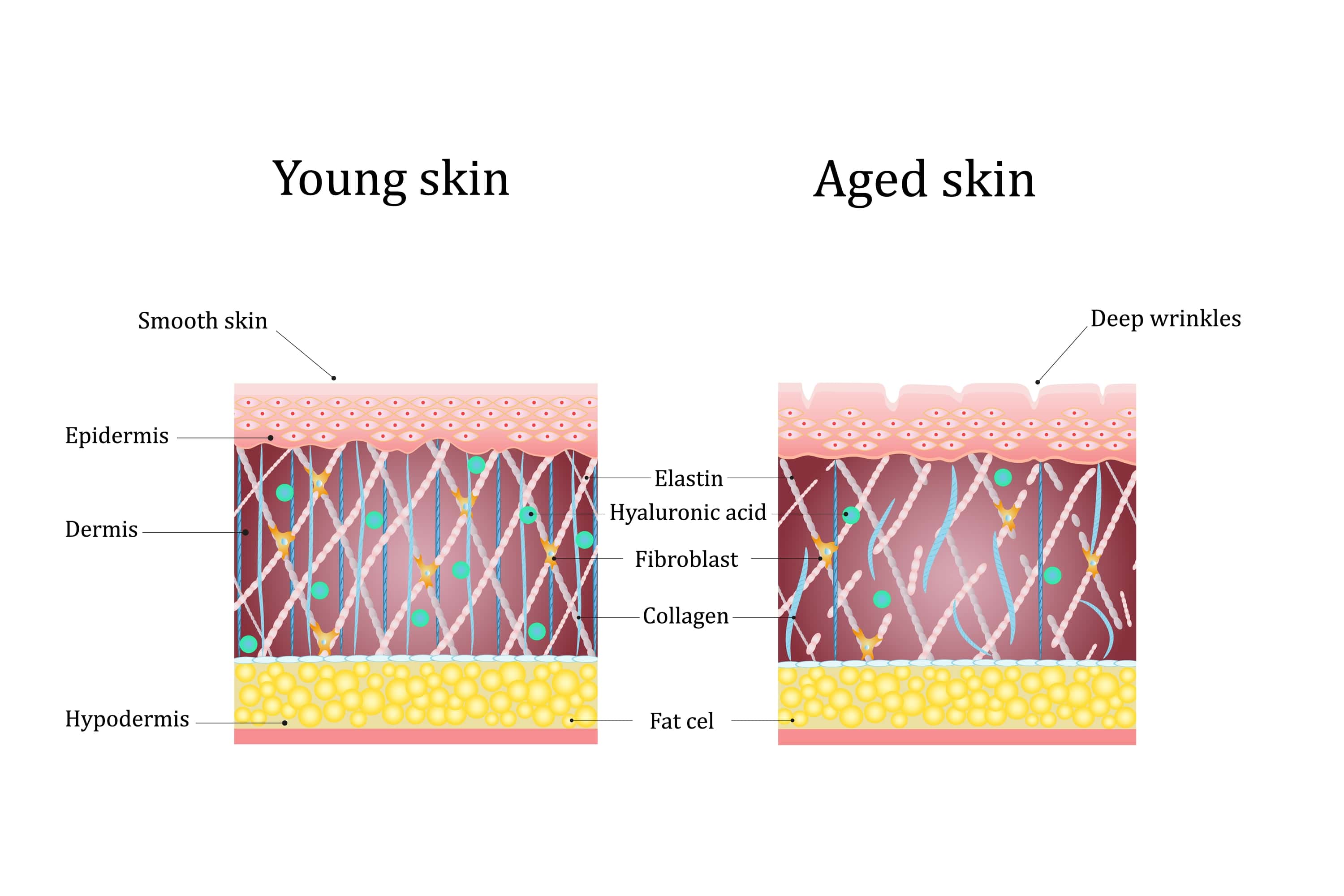 comparison between young skin and aged skin