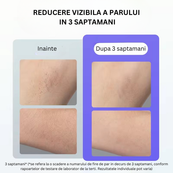 Epilator IPL 990.000 impulsuri, 5 trepte de viteza, 4 moduri de utilizare, tehnologie Ice Cooling pentru epilare definitiva si rejuvenare