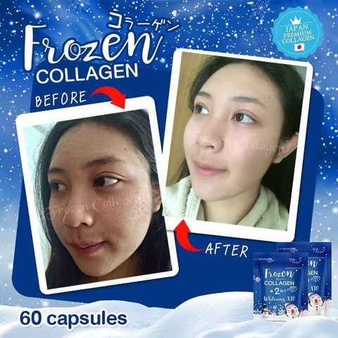 Frozen Collagen Authentic from Thailand BUY 1 TAKE 1 with Snail White –  Gorgeousmeshop
