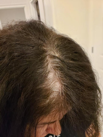 My Gray Hair Before the Two Steps