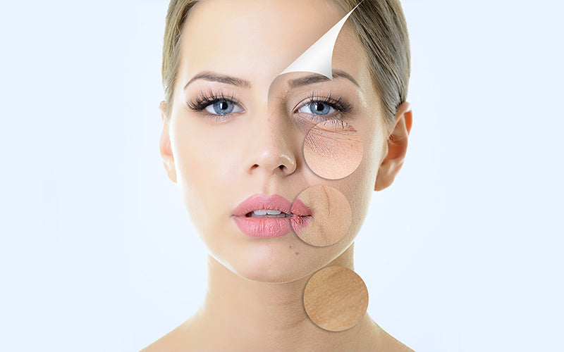 Do Makeup Wipes Clean Your Face? Dermatologists Explain