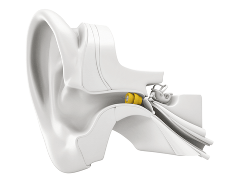 A person with a hearing test to determine if they are a good candidate for Lyric hearing aids