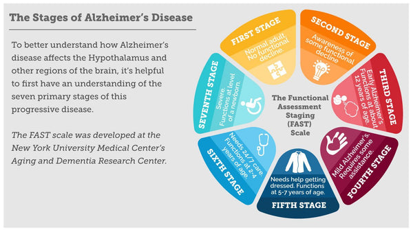 Infographic showing stages of dementia