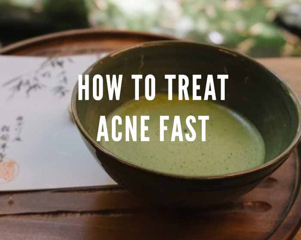 DISCOVER HOW TO CURE ACNE | banish how to treat acne fast green