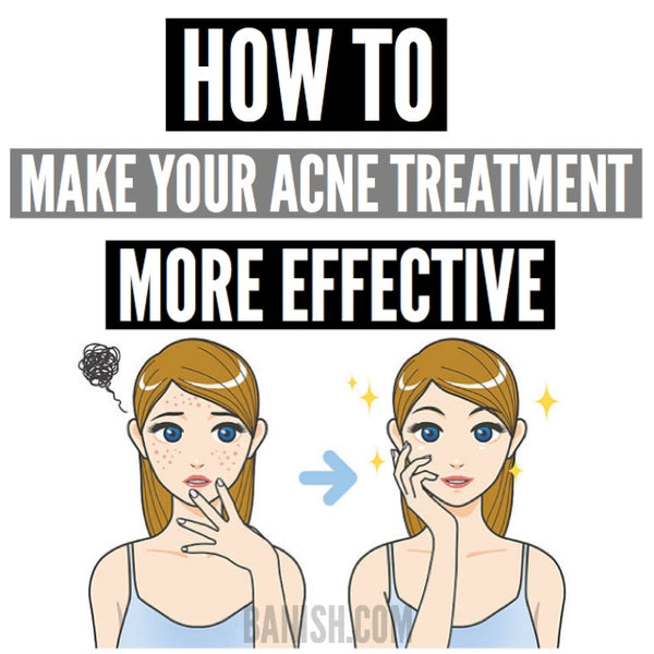 How to Make Your Acne Treatment More Effective