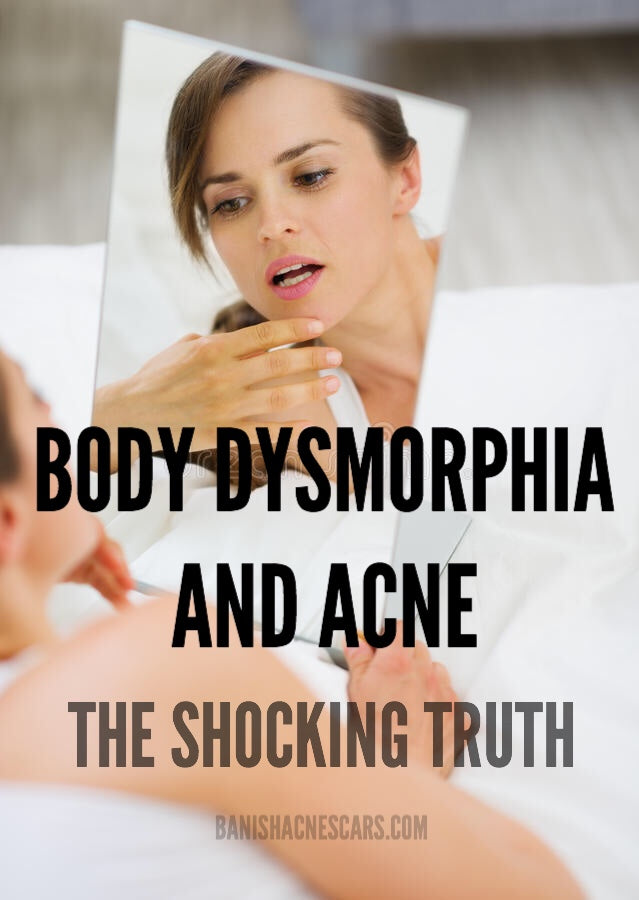 body-dysmorphia-and-acne-the-shocking-truth-banish