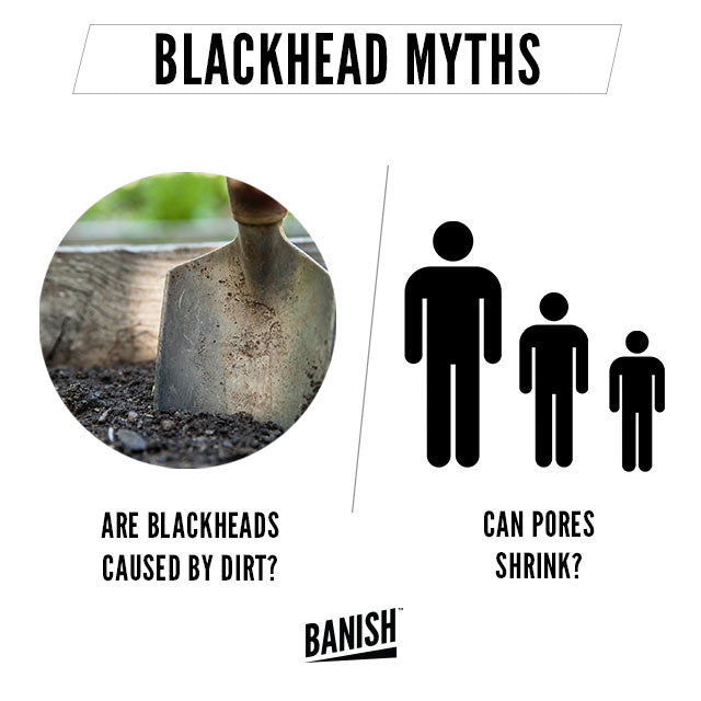 blackhead myths