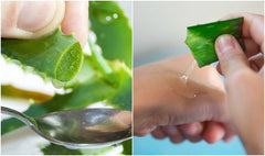 Aloe Vera For Acne Scars The Benefits And How To Use