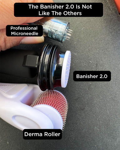 banish compared to dr pen and other home microneedle
