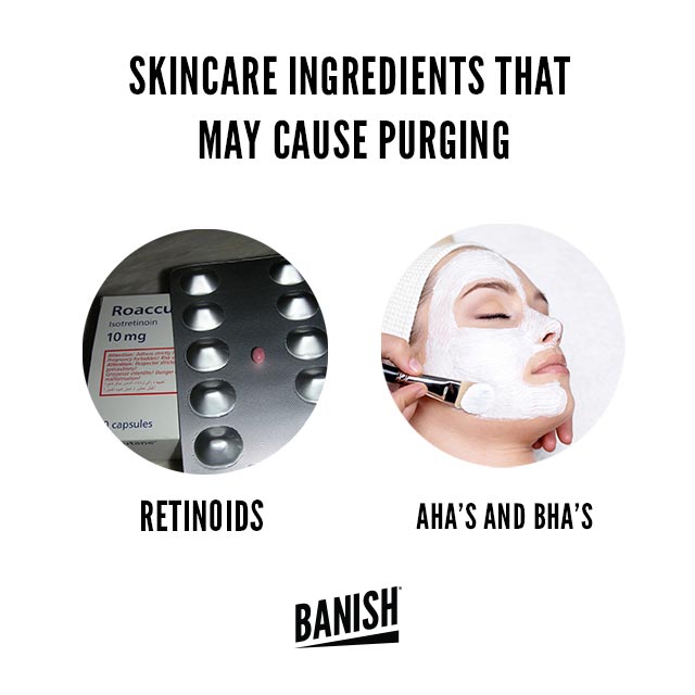purging skincare ingredients