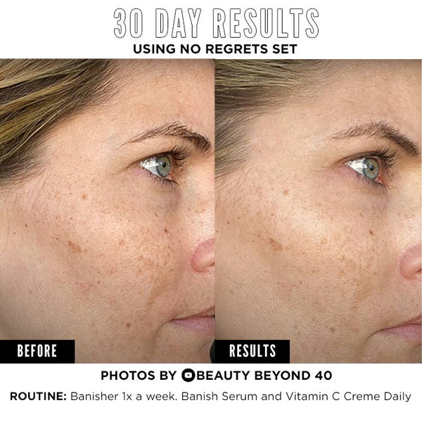 beautybeyond40 before after banish