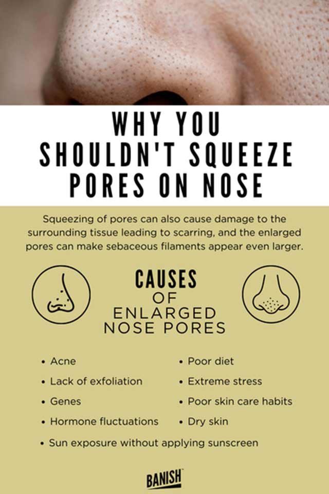 squeeze nose pores inforgraphic 
