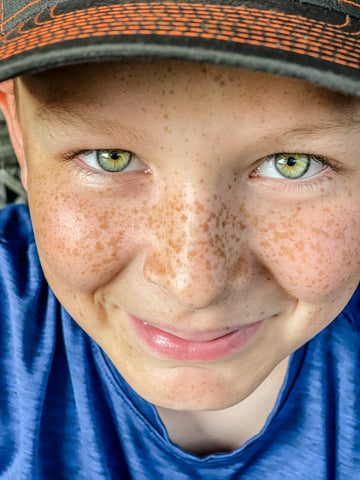 Freckles Close Up