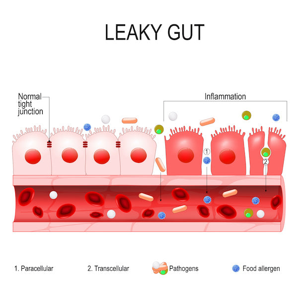 Leaky Gut Syndrom