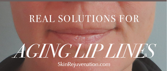 Aging Lip Lines: Laser, Profractional, Ultrasonic, and Home Care
