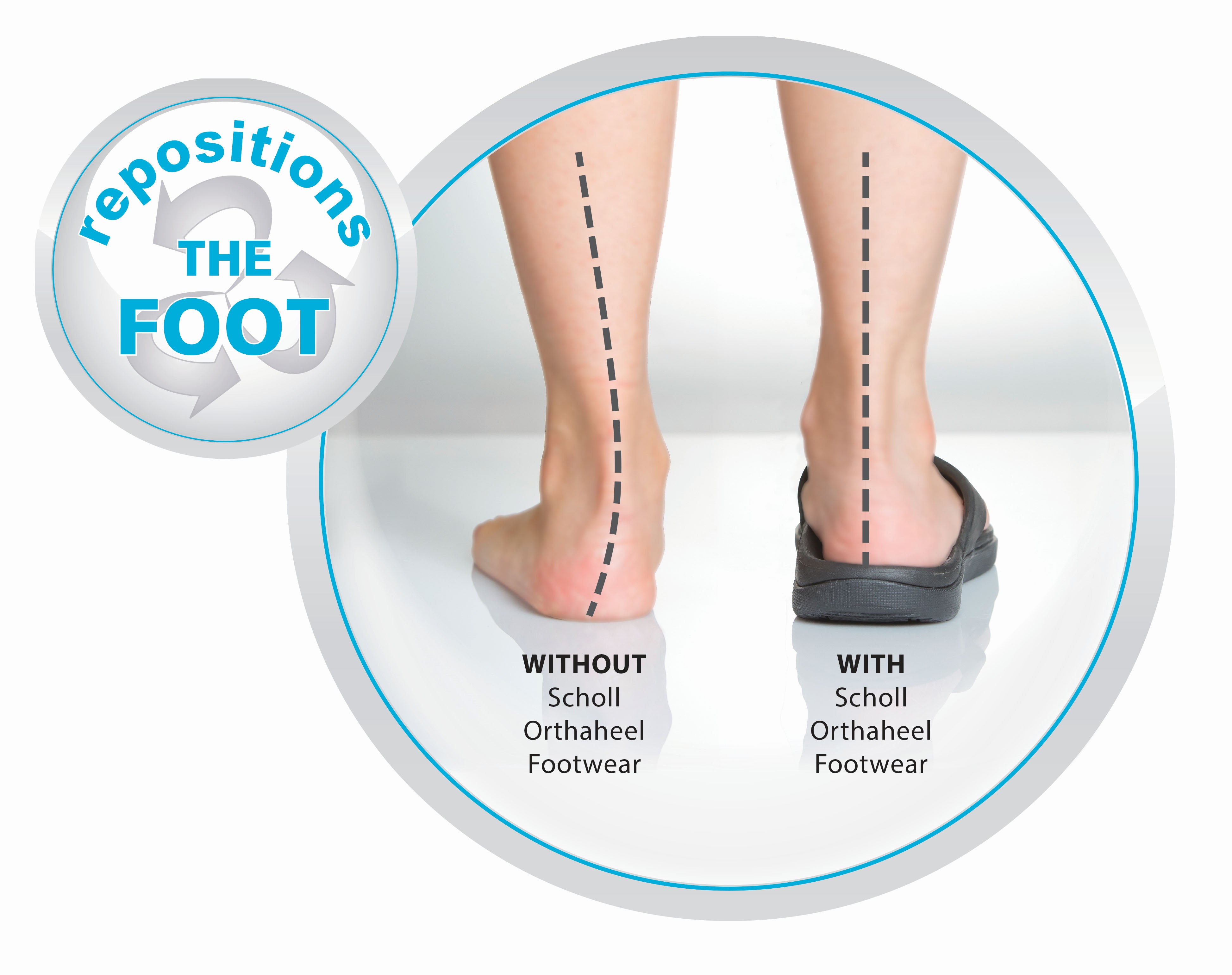 scholl foot arch supports