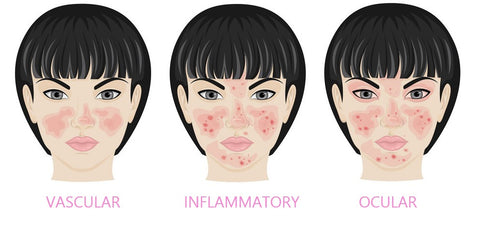 Types Of Rosacea