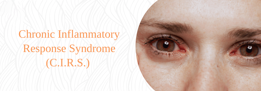 Chronic Inflammatory Response Syndrome (C.I.R.S.)
