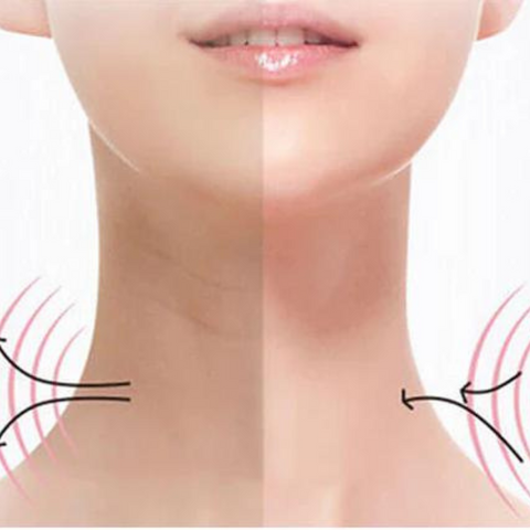L'image montre une femme montrant l'état du visage et du cou avant et après