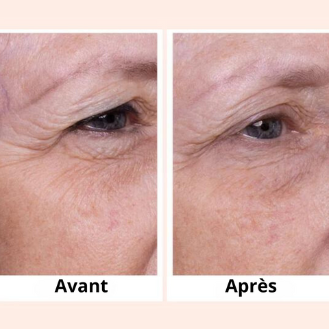 L'image montre le visage d'une femme âgée avant et après l'utilisation du l'appareil masseur