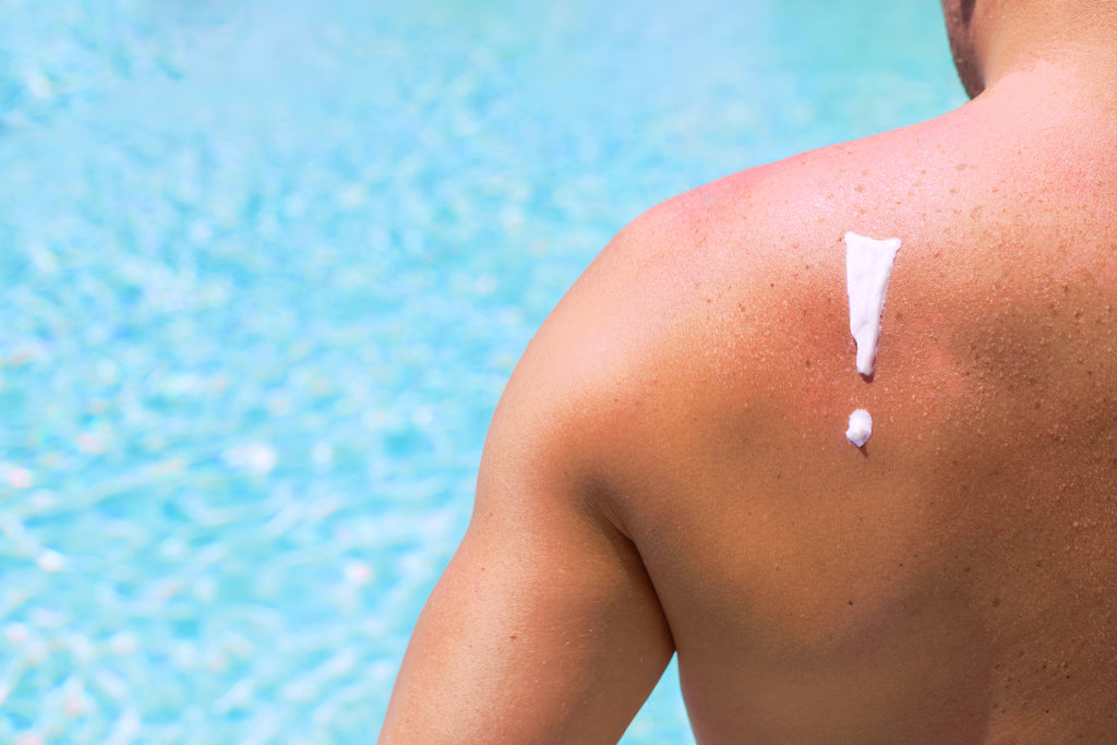 What Not to Do After You Get Sunburned