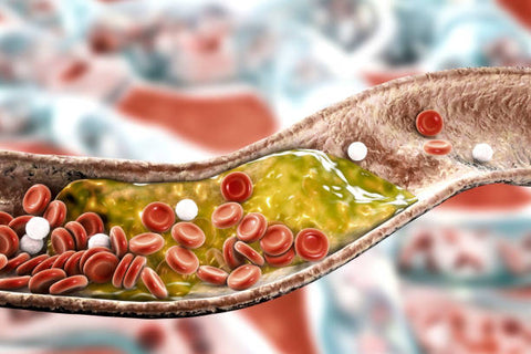 cholesterol in blood