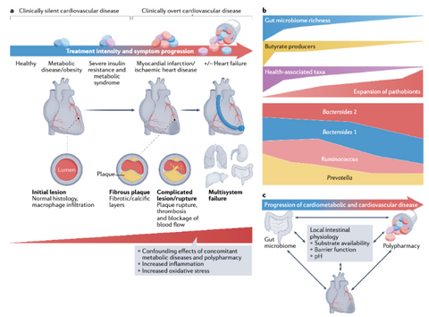 CVD progression in heart 