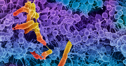 purple and yellow image of bacteria
