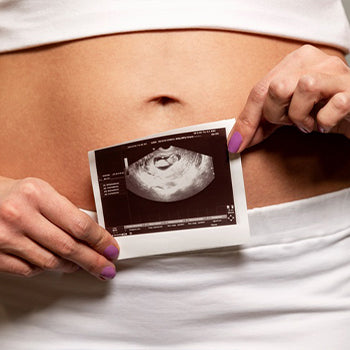 Woman holding her 2 months pregnant ultrasound photo