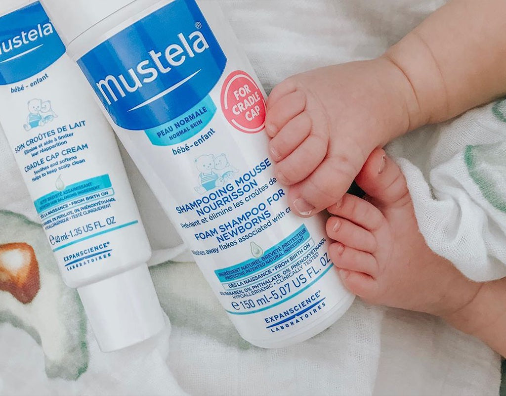 Mustela products to help with cradle cap