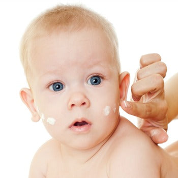 Eczema-prone baby having cream applied
