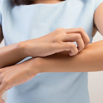 Woman scratching her eczema on her arm