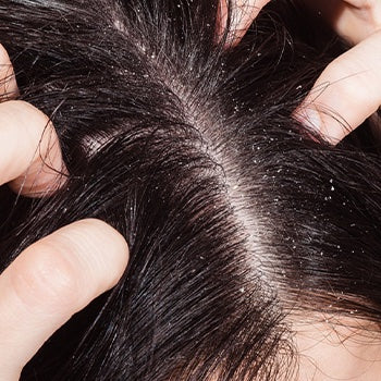 Woman scratching her scalp