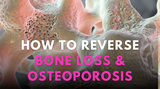 Osteoporosis and the Benefits of Plant-Based Calcium for bone loss