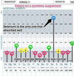 HairQ test results with high selenium