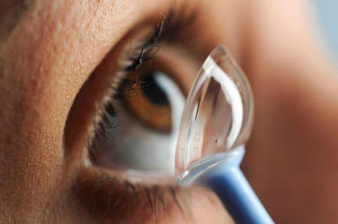 scleral contact lenses fit over the sclera of the eye