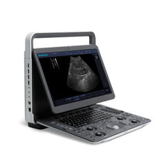 SonoScape E1V Small Animal Ultrasound | KeeboVet