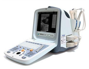 Chison ECO5 Vet Color Doppler Ultrasound Machine – KeeboVet Veterinary  Ultrasound Equipment