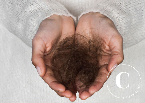 What is postpartum hair loss