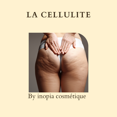 Quelles sont les 3 types de cellulites et comment y remédier