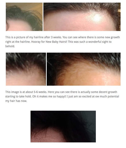 7 Hair serum for grey hair Grow your mane thicker darker  healthier with  THESE formulations  PINKVILLA